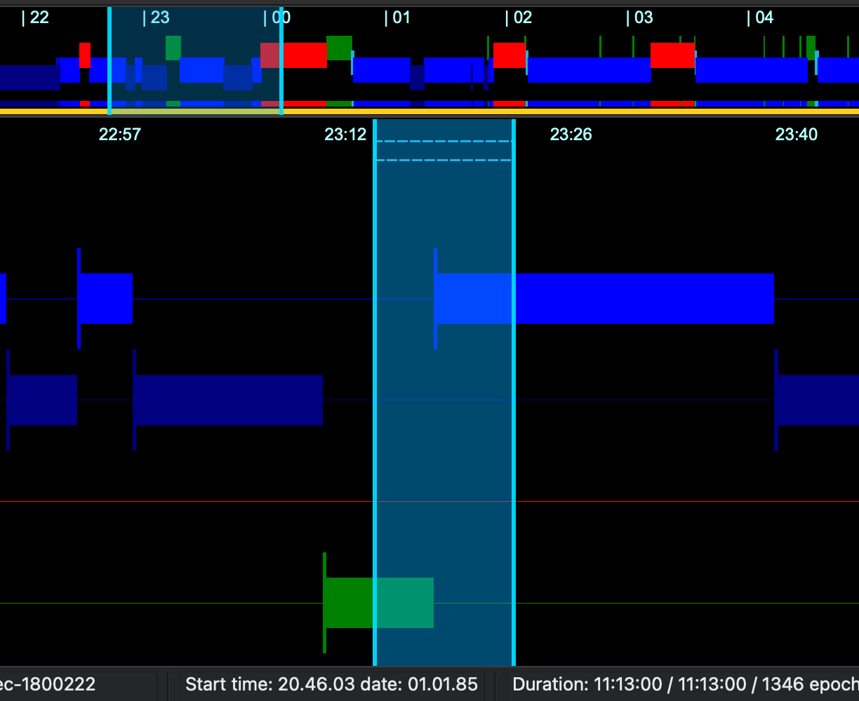 Selecting an interval to annotate