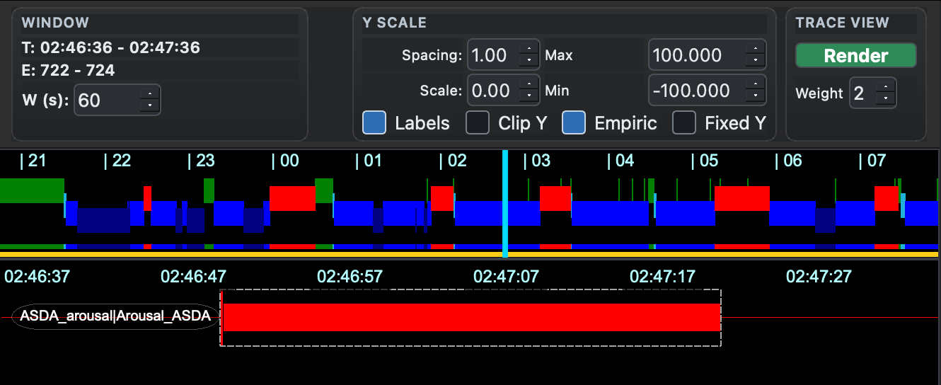 Annotation jump window set to 60 seconds