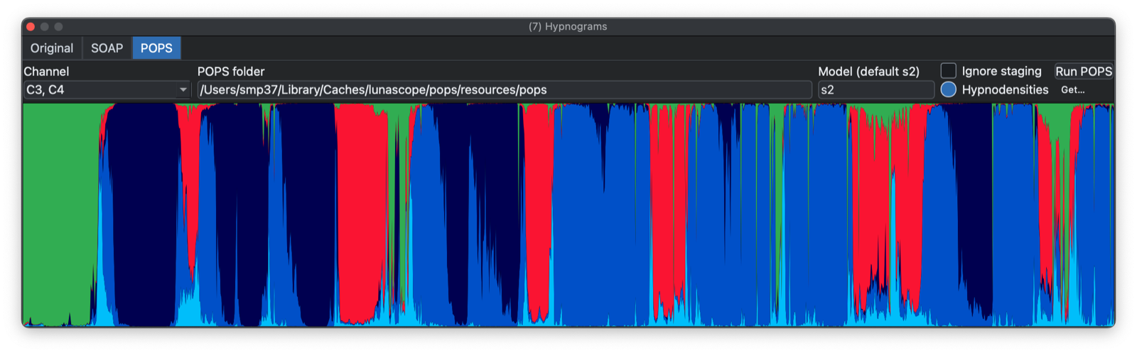 POPS Hypnodensity