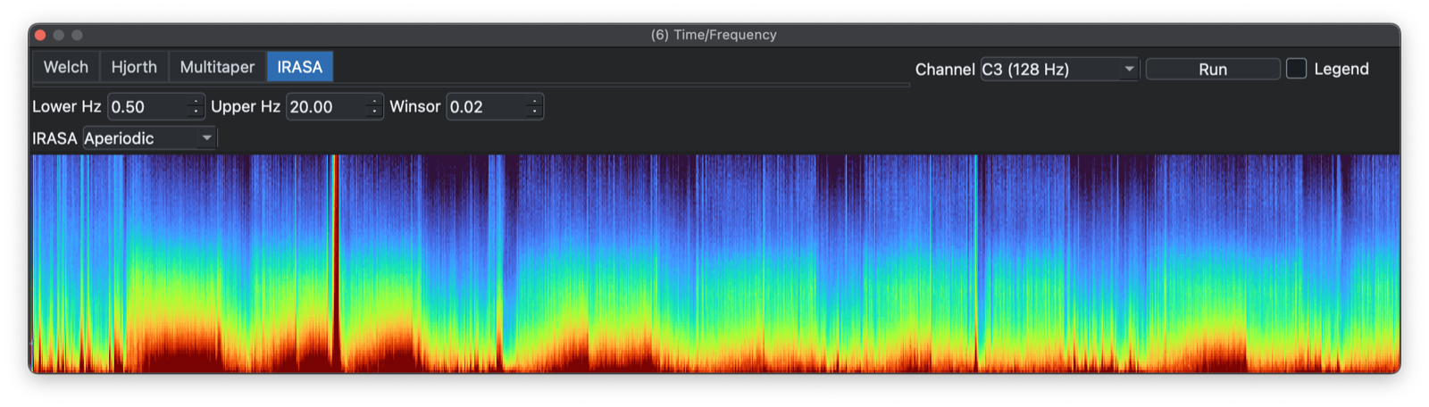 IRASA aperiodic spectrogram