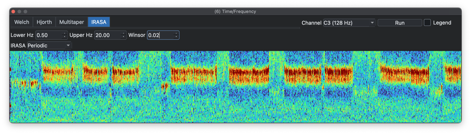 IRASA periodic spectrogram