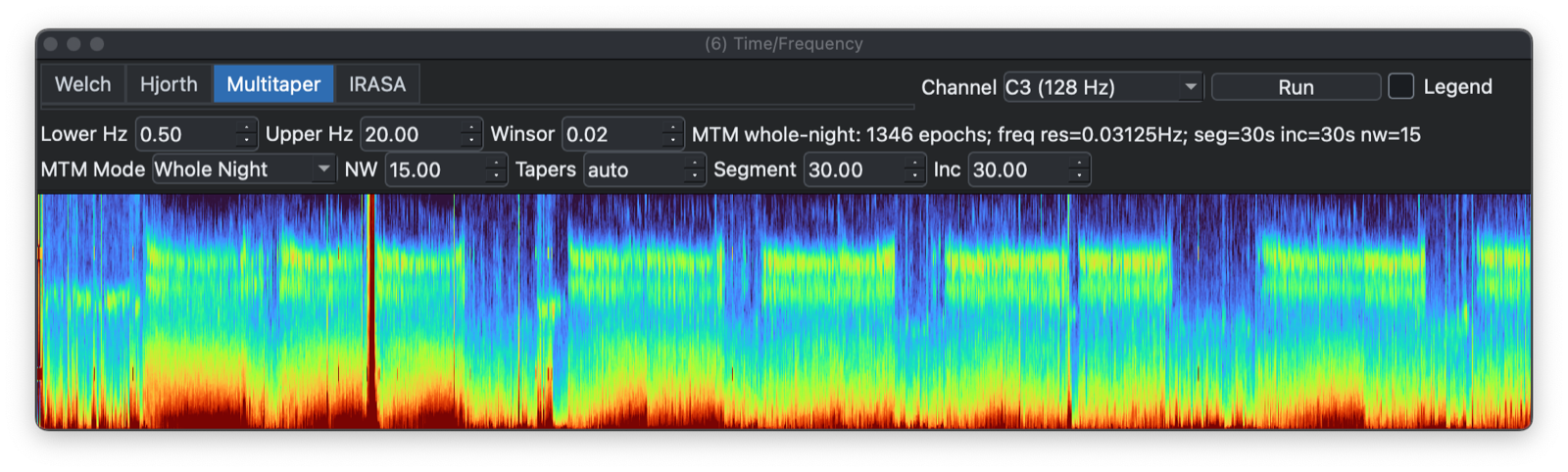 MT spectrogram 1