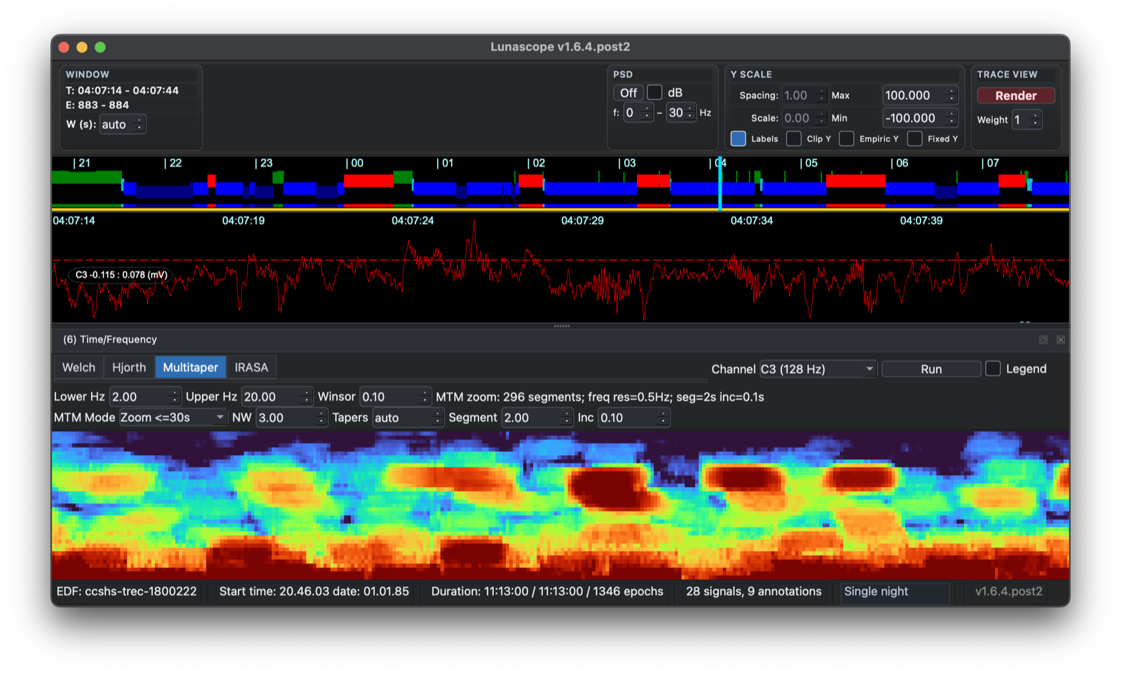 MT spectrogram 2