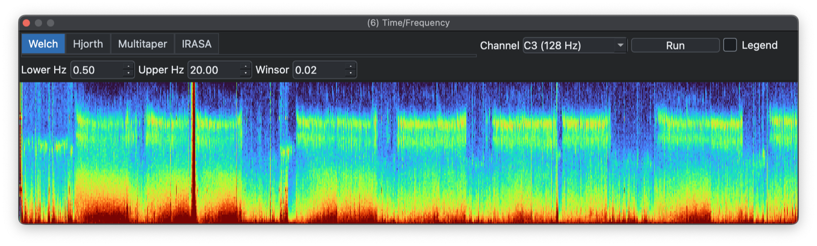 Time-frequency