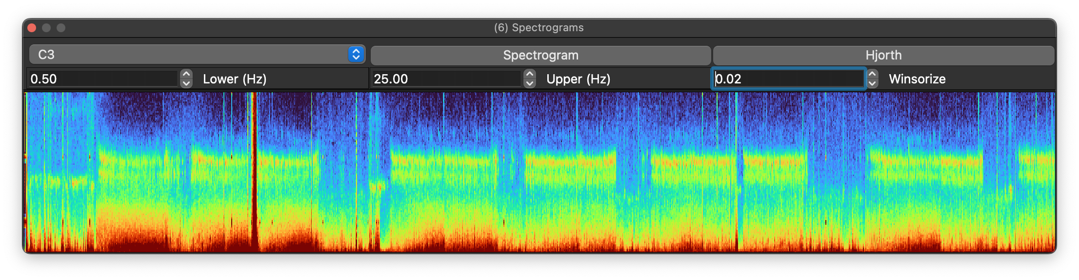 Spectrograms
